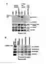 Fig. 03 - Method for diagnosing acute lymphomic leukemia (ALL) using miR-146a
