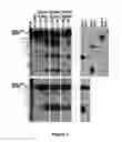 Fig. 04 - Method for diagnosing acute lymphomic leukemia (ALL) using miR-146a