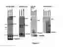 Fig. 08 - Method for diagnosing acute lymphomic leukemia (ALL) using miR-146a