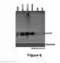Fig. 09 - Method for diagnosing acute lymphomic leukemia (ALL) using miR-146a