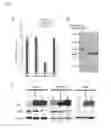 Fig. 09 - ADRB2 cancer markers