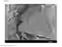 Fig. 02 - NOVEL CRYSTALLINE PHARMACEUTICAL PRODUCT