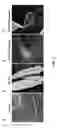 Fig. 02 - COMPOSITIONS AND METHODS FOR TREATING CORNEAL HAZE