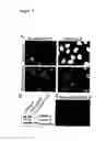 Fig. 02 - Down regulation of the gene expression by means of nucleic acid-loaded virus-like particles