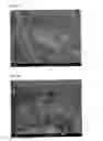 Fig. 08 - Method for producing phosphonic acid metal salt fine particles