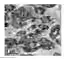 Fig. 01 - Polypropylene resin suitable for soft nonwoven applications