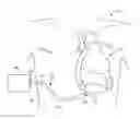 Fig. 01 - Assembly and method for stabilizing a percutaneous cable