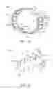 Fig. 13 - Assembly and method for stabilizing a percutaneous cable