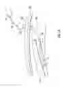 Fig. 02 - LAPAROSCOPIC SURGICAL RETRACTION DEVICE