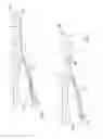 Fig. 06 - LAPAROSCOPIC SURGICAL RETRACTION DEVICE