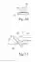 Fig. 07 - Instruments for use in femoroacetabular impingement procedures