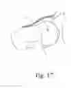Fig. 11 - Instruments for use in femoroacetabular impingement procedures