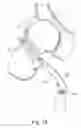 Fig. 12 - Instruments for use in femoroacetabular impingement procedures