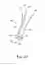 Fig. 14 - Instruments for use in femoroacetabular impingement procedures
