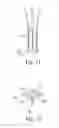 Fig. 15 - Instruments for use in femoroacetabular impingement procedures