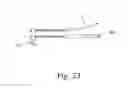 Fig. 16 - Instruments for use in femoroacetabular impingement procedures