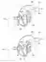 Fig. 02 - SYSTEM AND METHOD FOR DETECTING AND TREATING CARDIOVASCULAR DISEASE