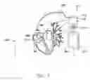 Fig. 03 - SYSTEM AND METHOD FOR DETECTING AND TREATING CARDIOVASCULAR DISEASE