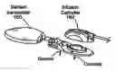 Fig. 01 - COMBINED SENSOR AND INFUSION SETS