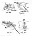 Fig. 09 - COMBINED SENSOR AND INFUSION SETS