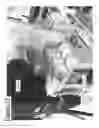 Fig. 28 - Robotic knee testing device, subjective patient input device and methods for using same