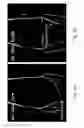Fig. 04 - MRI using hybrid image