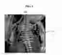 Fig. 04 - ULTRASOUND SYSTEM AND METHOD OF MEASURING FETAL RIB