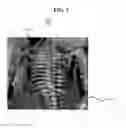 Fig. 06 - ULTRASOUND SYSTEM AND METHOD OF MEASURING FETAL RIB
