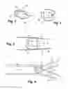 Fig. 02 - Apparatus and method for sensor deployment and fixation