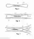 Fig. 03 - Apparatus and method for sensor deployment and fixation