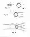 Fig. 05 - Apparatus and method for sensor deployment and fixation
