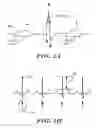 Fig. 02 - Methods and devices that identify overdetection in implantable cardiac systems