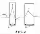 Fig. 05 - Methods and devices that identify overdetection in implantable cardiac systems