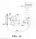 Fig. 15 - Methods and devices that identify overdetection in implantable cardiac systems