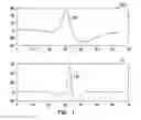 Fig. 02 - Classification of supraventricular and ventricular cardiac rhythms using cross channel timing algorithm