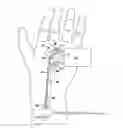 Fig. 01 - Nerve stimulator measuring device