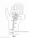 Fig. 02 - Nerve stimulator measuring device