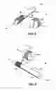 Fig. 05 - Twisted ribbon wire guidewire coil