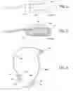 Fig. 05 - MECHANICAL STIMULATION WRAP AND METHOD OF USE