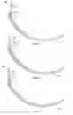 Fig. 09 - Adjustable Modular Knee Brace