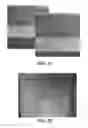 Fig. 16 - Skin treatment devices and methods with pre-stressed configurations