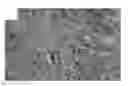 Fig. 01 - Use of a polyurethane foam as a wound dressing in negative pressure therapy