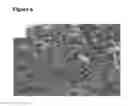 Fig. 04 - Use of a polyurethane foam as a wound dressing in negative pressure therapy
