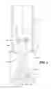 Fig. 05 - HIFU applicator