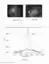 Fig. 15 - Laser activated nanothermolysis of cells