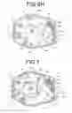 Fig. 08 - Implantable adjustable valve