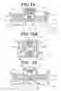 Fig. 13 - Implantable adjustable valve