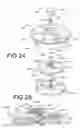 Fig. 16 - Implantable adjustable valve