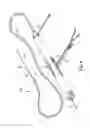 Fig. 05 - THERAPEUTIC AGENT DELIVERY SYSTEM, DEVICE AND METHOD FOR LOCALIZED APPLICATION OF THERAPEUTIC SUBSTANCES TO A BIOLOGICAL CONDUIT