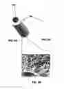 Fig. 07 - METHOD AND APPARATUS FOR MAKING A POROUS BIODEGRADEABLE MEDICAL IMPLANT DEVICE